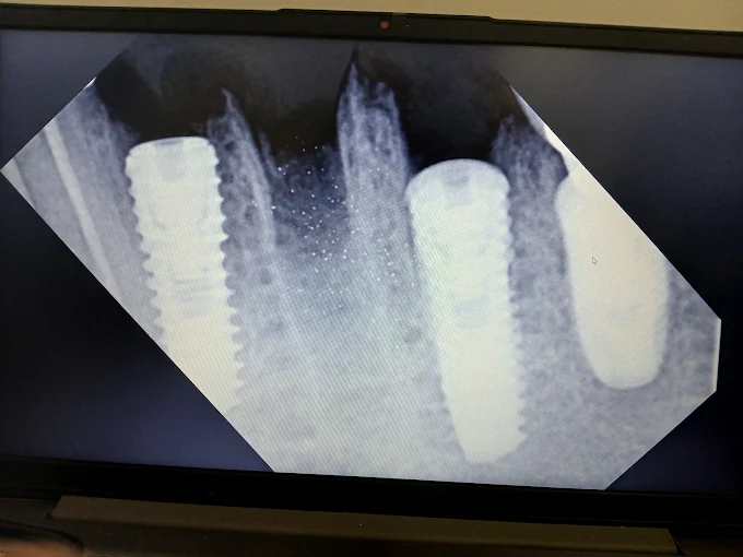 Pooja Smile Care Dental Gallery Image 5